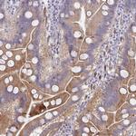 PSMG1 Antibody in Immunohistochemistry (Paraffin) (IHC (P))
