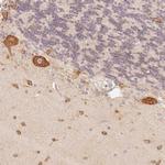 FAM189A2 Polyclonal Antibody