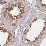 AGTPBP1 Antibody in Immunohistochemistry (Paraffin) (IHC (P))
