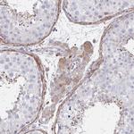 FBXL13 Polyclonal Antibody