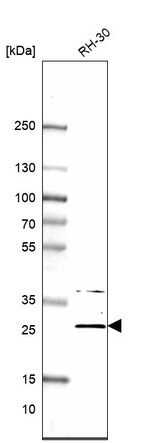 DGUOK Antibody in Western Blot (WB)