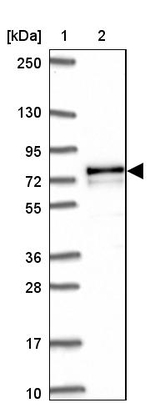 Adenylate Kinase 5 Antibody in Western Blot (WB)