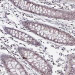 SETBP1 Polyclonal Antibody