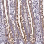 MRPS2 Polyclonal Antibody