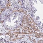 SARDH Polyclonal Antibody