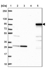 SARDH Antibody in Western Blot (WB)