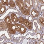 SNX8 Antibody in Immunohistochemistry (Paraffin) (IHC (P))