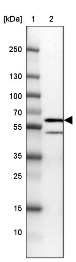 SNX8 Antibody in Western Blot (WB)