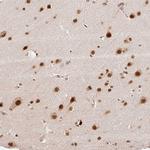 INTS8 Antibody in Immunohistochemistry (Paraffin) (IHC (P))
