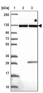 INTS8 Antibody in Western Blot (WB)
