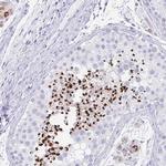 RLF Polyclonal Antibody