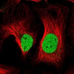 V-ATPase D Polyclonal Antibody