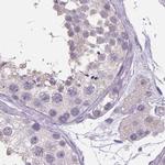 V-ATPase D Antibody in Immunohistochemistry (IHC)