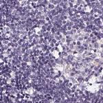 V-ATPase D Antibody in Immunohistochemistry (IHC)
