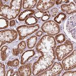 ATP Synthase B1 Antibody in Immunohistochemistry (Paraffin) (IHC (P))