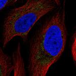 ATP Synthase B1 Polyclonal Antibody