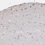 RAB5IF Antibody in Immunohistochemistry (Paraffin) (IHC (P))