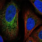 FLJ37770 Polyclonal Antibody