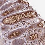 FLJ37770 Antibody in Immunohistochemistry (Paraffin) (IHC (P))