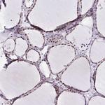 WDR72 Antibody in Immunohistochemistry (IHC)