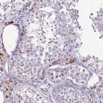 HOXB4 Antibody in Immunohistochemistry (Paraffin) (IHC (P))