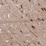 OR4N4 Antibody in Immunohistochemistry (Paraffin) (IHC (P))