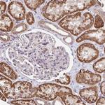 TSPAN31 Antibody in Immunohistochemistry (Paraffin) (IHC (P))