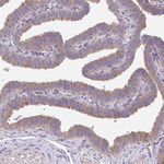 TSPAN31 Antibody in Immunohistochemistry (Paraffin) (IHC (P))