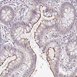 TSPAN31 Antibody in Immunohistochemistry (Paraffin) (IHC (P))