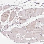 PIWIL4 Antibody in Immunohistochemistry (Paraffin) (IHC (P))