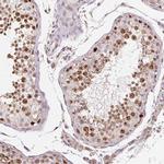 PIWIL4 Polyclonal Antibody