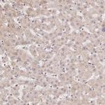 PIWIL4 Antibody in Immunohistochemistry (IHC)