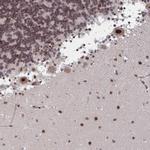 RNF212 Polyclonal Antibody