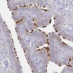 LRRC23 Antibody in Immunohistochemistry (Paraffin) (IHC (P))