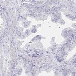 LRRC23 Antibody in Immunohistochemistry (IHC)