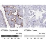 LRRC23 Antibody