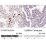 ANKRD31 Polyclonal Antibody