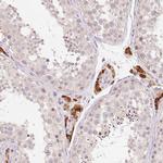 ANKRD31 Antibody in Immunohistochemistry (IHC)