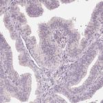 ANKRD31 Antibody in Immunohistochemistry (IHC)