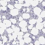 LRC58 Antibody in Immunohistochemistry (Paraffin) (IHC (P))