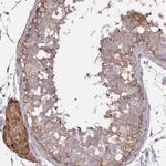 ZFYVE28 Polyclonal Antibody