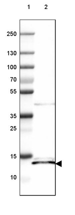 ISCU Antibody in Western Blot (WB)