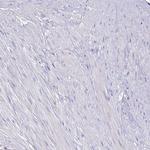 YARS2 Polyclonal Antibody