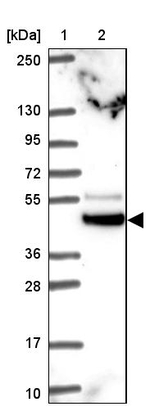 TRIM44 Antibody in Western Blot (WB)