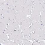 VPS4B Antibody in Immunohistochemistry (Paraffin) (IHC (P))