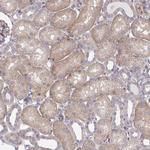 CEMP1 Antibody in Immunohistochemistry (Paraffin) (IHC (P))