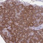 CEMP1 Antibody in Immunohistochemistry (Paraffin) (IHC (P))