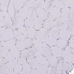 CEMP1 Antibody in Immunohistochemistry (Paraffin) (IHC (P))