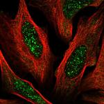 ACD Polyclonal Antibody