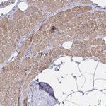 ZNF805 Polyclonal Antibody